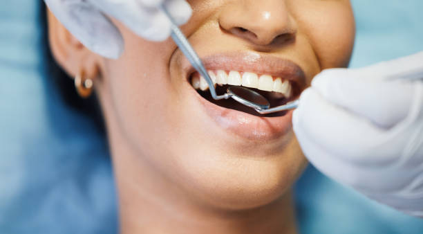 Best Emergency Wisdom Teeth Removal in Gantt, SC