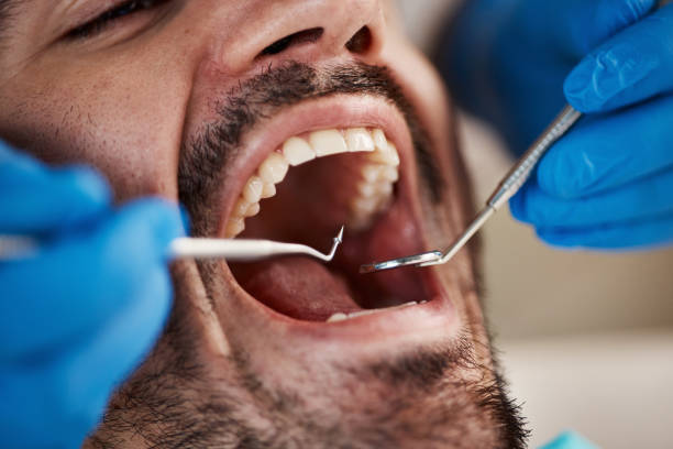 Fast & Reliable Emergency Dental Services in SC